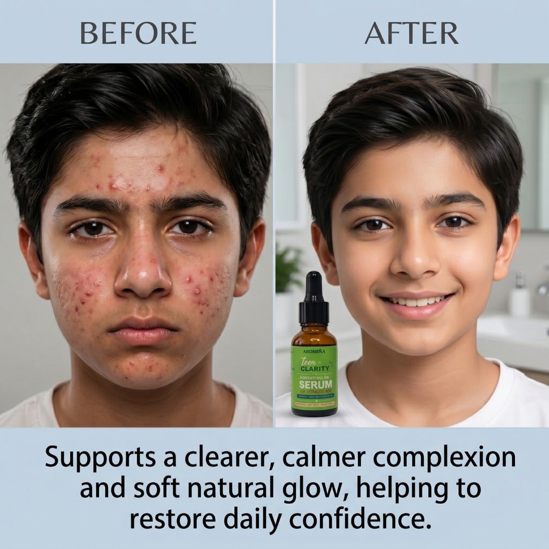 Teen Clarity Essential Oil Serum